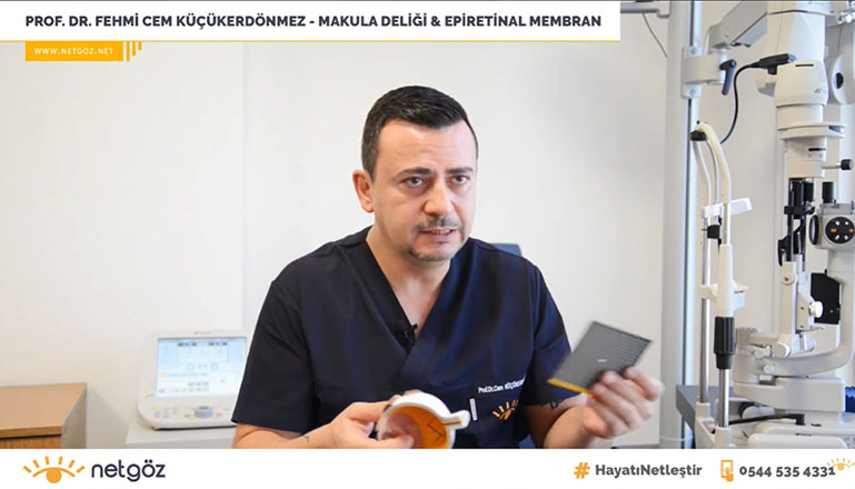 Prof. Dr. Fehmi Cem Küçükerdönmez, Retina Hastalıkları ve Retina Cerrahisi - İzmir Göz Doktoru